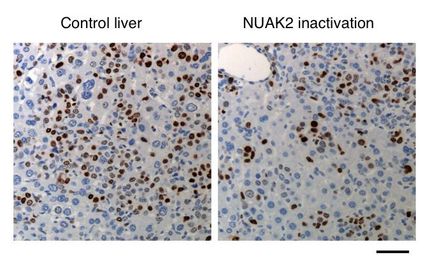 'Druggable' cancer target found in pathway regulating organ size