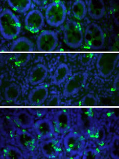 Obese People Lack Cells with Satiety Hormones